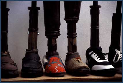 Prosthetic legs with shoes