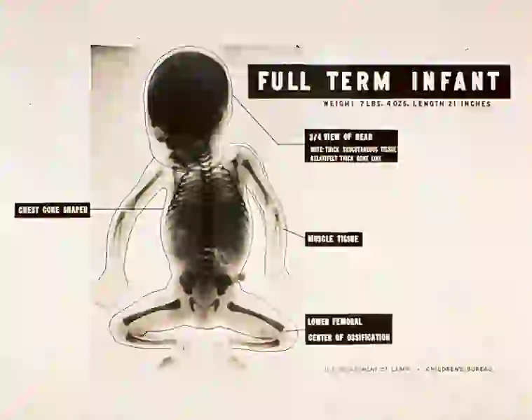 An x-ray of a baby’s skull