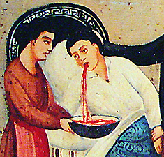 Close-up of Vincenzo Grimaldi, suffering from tuberculosis throws up blood into a basin, 1927, oil on tin.  From the Santuario dei Ss. Martiri Alfio, Cirino e Filadelfo, (Sanctuary of the Martyred Saints Alfio, Cirinio, and Filadelfo), Trecastagni, Sicily. Courtesy Giuseppe Maimone Editore, Catania and Mario Alberghina.