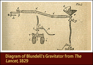 Labeled blueprint of various components of transfusion instrument, including part resembling a funnel.