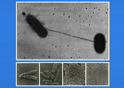 Microphotograph of two E. coli bacteria exchanging DNA through conjugation.  Four views of E. coli bacteria by scanning electron microscope.