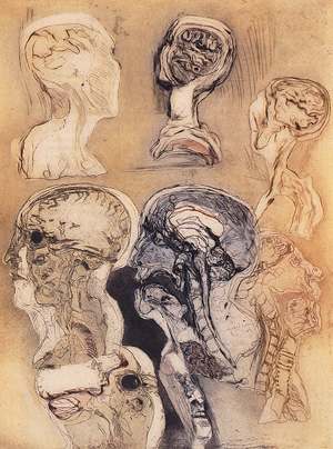 A series of sagittal sections of a human head embedded in plastic blocks.