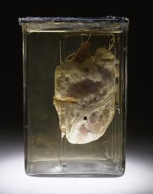 Heart of a 26-year-old man, perforated by a bullet, New York, 1937