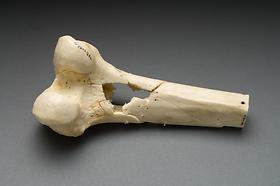 Leg bone from the Ragsdale Gunshot Wound Study, 1984