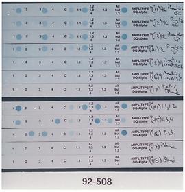 PCR DNA tests, Bloodsworth case, 1993